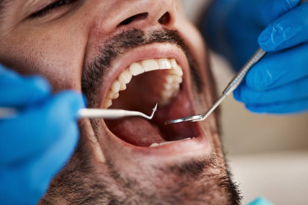 Best Emergency Dental Services for Seniors in Benbrook, TX